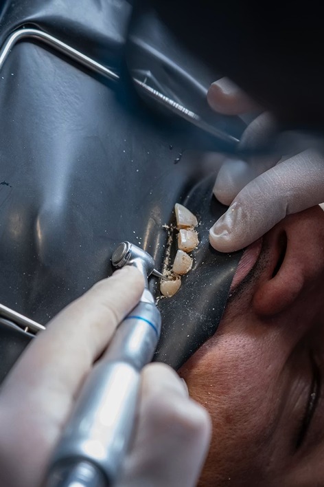 Endodoncie